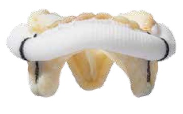 Мітральний клапан Epic™ Plus